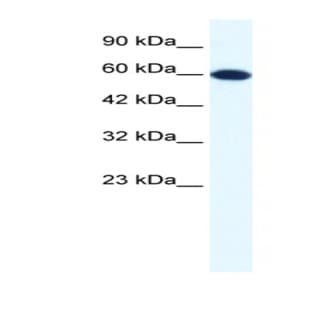 anti-DEAD (Asp-Glu-Ala-Asp) Box Polypeptide 6 (DDX6) (N-Term) antibody avatar