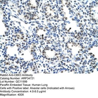 anti-Chromobox Homolog 3 (CBX3) (Middle Region) antibody avatar