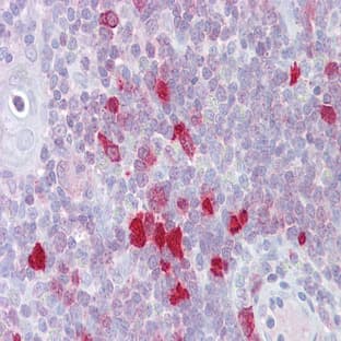 anti-Distal-Less Homeobox 5 (DLX5) (N-Term) antibody