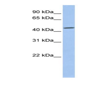 anti-Casein Kinase 2, alpha 1 Polypeptide (CSNK2A1) (Middle Region) antibody avatar
