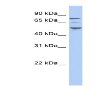 anti-Casein Kinase 1, epsilon (CSNK1E) (N-Term) antibody avatar