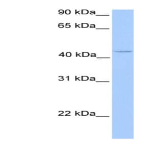 anti-Chromosome 17 Open Reading Frame 97 (C17orf97) (N-Term) antibody avatar