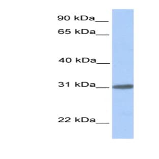 anti-Chromosome 7 Open Reading Frame 61 (C7orf61) (C-Term) antibody avatar