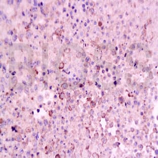 anti-CD8a Molecule (CD8A) antibody avatar