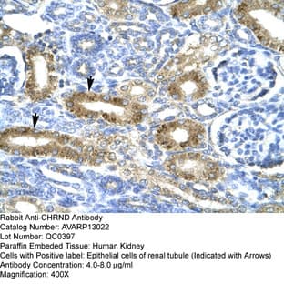 anti-Cholinergic Receptor, Nicotinic, delta (Muscle) (CHRND) (N-Term) antibody avatar