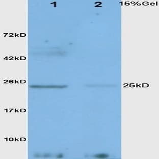 anti-Adiponectin, C1Q and Collagen Domain Containing (ADIPOQ) antibody avatar