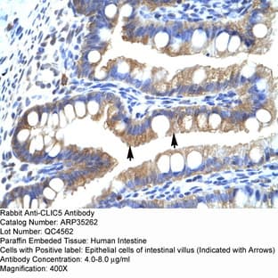 anti-Chloride Intracellular Channel 5 (CLIC5) (Middle Region) antibody avatar