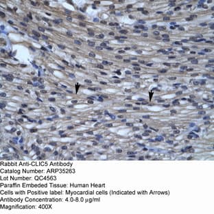 anti-Chloride Intracellular Channel 5 (CLIC5) (C-Term) antibody avatar