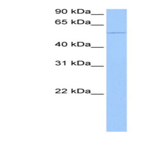 anti-Chimerin 1 (CHN1) (Middle Region) antibody avatar