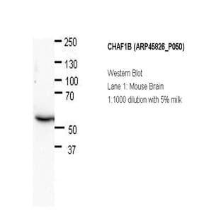 anti-Chromatin Assembly Factor 1, Subunit B (p60) (CHAF1B) (N-Term) antibody avatar