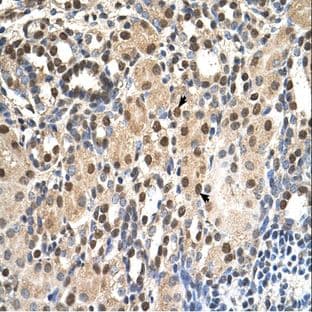 anti-Acidic (Leucine-Rich) Nuclear phosphoprotein 32 Family, Member E (ANP32E) (Middle Region) antibody avatar