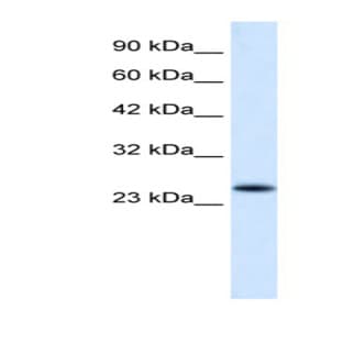 anti-Charged Multivesicular Body Protein 3 (CHMP3) (N-Term) antibody avatar