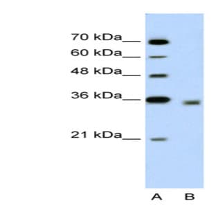 anti-2,4-Dienoyl CoA Reductase 2, Peroxisomal (DECR2) (N-Term) antibody avatar