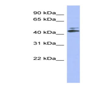 anti-Cytochrome P450, Family 20, Subfamily A, Polypeptide 1 (CYP20A1) (N-Term) antibody avatar