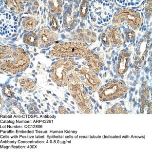 anti-CTD Small Phosphatase-Like Protein (CTDSPL) (N-Term) antibody avatar