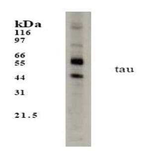 anti-Microtubule-Associated Protein tau (MAPT) (pan) antibody avatar