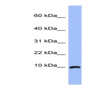 anti-Acyl-CoA Binding Domain Containing 7 (ACBD7) (N-Term) antibody avatar