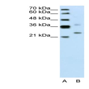 anti-DCN1, Defective in Cullin Neddylation 1, Domain Containing 1 (S. Cerevisiae) (DCUN1D1) (N-Term) antibody avatar