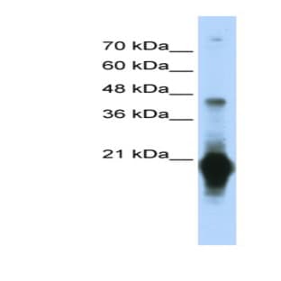 anti-Chromosome 17 Open Reading Frame 49 (C17orf49) (Middle Region) antibody avatar