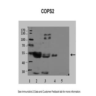 anti-COP9 Constitutive Photomorphogenic Homolog Subunit 2 (Arabidopsis) (COPS2) (N-Term) antibody avatar