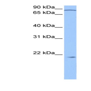 anti-Actin Related Protein 2/3 Complex, Subunit 3, 21kDa (ARPC3) (N-Term) antibody avatar