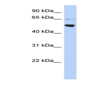 anti-Adaptor-Related Protein Complex 3, mu 2 Subunit (AP3M2) (Middle Region) antibody avatar