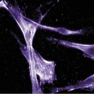 anti-Actin antibody avatar