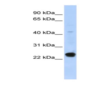 anti-Chromosome 16 Open Reading Frame 80 (C16orf80) (Middle Region) antibody avatar