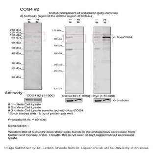 anti-Component of Oligomeric Golgi Complex 4 (COG4) (Middle Region) antibody avatar