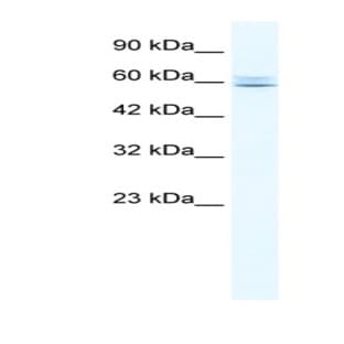 anti-Core-binding Factor, Runt Domain, alpha Subunit 2, Translocated To, 3 (CBFA2T3) (N-Term) antibody avatar