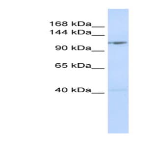 anti-DEAD (Asp-Glu-Ala-Asp) Box Polypeptide 46 (DDX46) (Middle Region) antibody avatar
