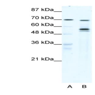 anti-DEAD (Asp-Glu-Ala-Asp) Box Polypeptide 55 (DDX55) (N-Term) antibody avatar