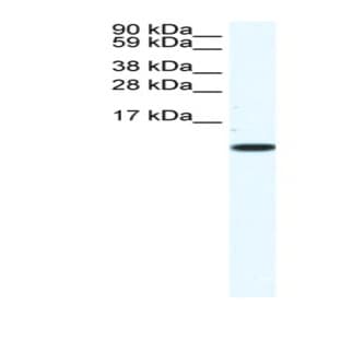 anti-Chemokine (C-C Motif) Ligand 5 (CCL5) (Middle Region) antibody avatar
