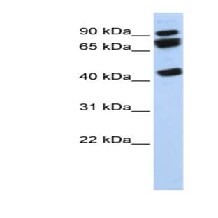 anti-DEAD (Asp-Glu-Ala-Asp) Box Polypeptide 17 (DDX17) (N-Term) antibody avatar