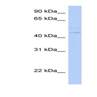 anti-Cytohesin 4 (CYTH4) (N-Term) antibody avatar