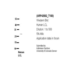 anti-Chromosome 21 Open Reading Frame 7 (C21orf7) (C-Term) antibody avatar