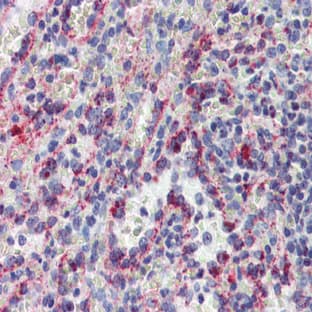 anti-Cytochrome B-245, beta Polypeptide (CYBB) (C-Term) antibody avatar