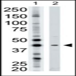 anti-ADP-Ribosyltransferase 3 (ART3) (N-Term), (AA 12-42) antibody avatar