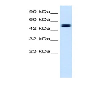 anti-Chloride Channel, Voltage-Sensitive 6 (CLCN6) (C-Term) antibody avatar