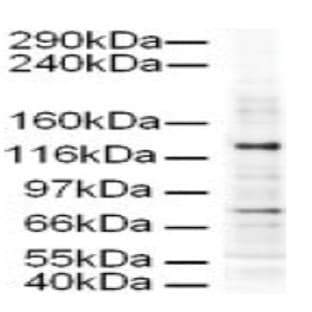 anti-Adaptor-Related Protein Complex 3, delta 1 Subunit (AP3D1) (AA 686-698) antibody avatar