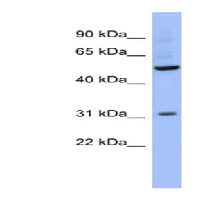 anti-RNA Binding Motif, Single Stranded Interacting Protein 3 (RBMS3) (Middle Region) antibody avatar