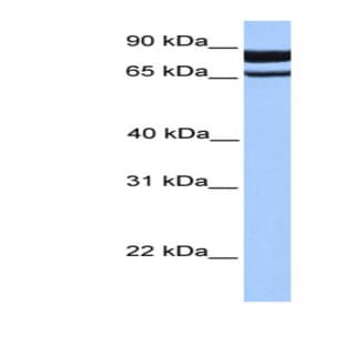 anti-phosphodiesterase 1C, Calmodulin-Dependent 70kDa (PDE1C) (N-Term) antibody avatar