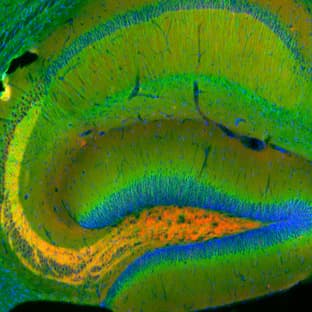 anti-Amphiphysin (AMPH) (AA 2-15) antibody avatar