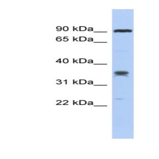 anti-Chromosome 6 Open Reading Frame 154 (C6orf154) (Middle Region) antibody avatar