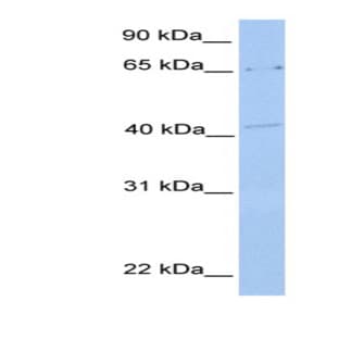 anti-Chromosome 6 Open Reading Frame 192 (C6orf192) (N-Term) antibody avatar