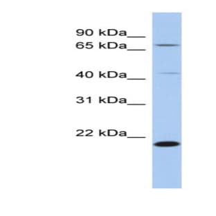 anti-Adenosylmethionine Decarboxylase 1 (AMD1) (N-Term) antibody avatar
