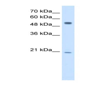 anti-B Lymphoid Tyrosine Kinase (BLK) (Middle Region) antibody avatar