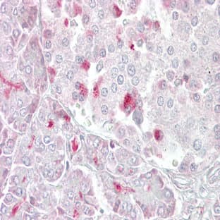 anti-5-Methyltetrahydrofolate-Homocysteine Methyltransferase (MTR) (C-Term) antibody