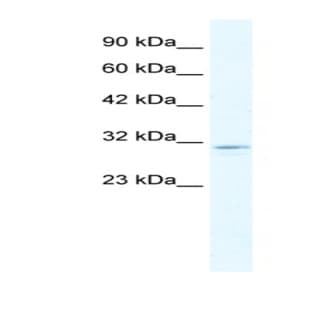 anti-Chloride Intracellular Channel 2 (CLIC2) (C-Term) antibody avatar
