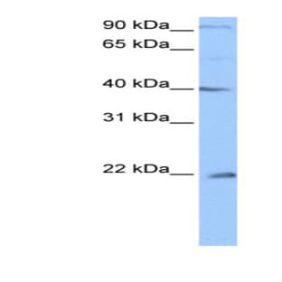 anti-Chromosome 4 Open Reading Frame 33 (C4orf33) (C-Term) antibody avatar